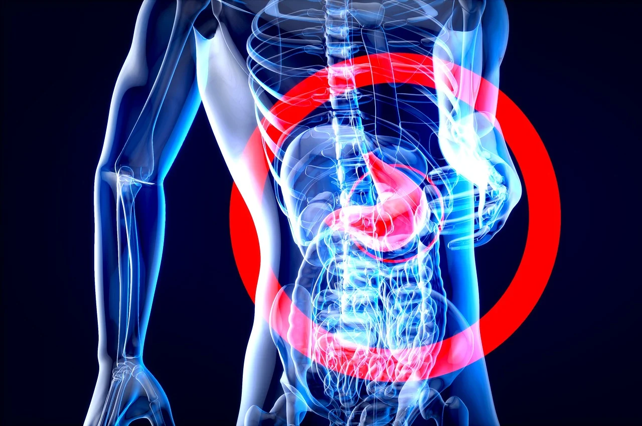 santé intestinal keto